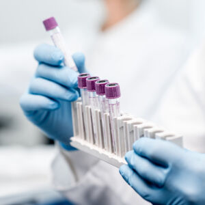 Genetic Testing for Breast Cancer: What You Need to Know