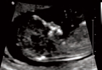 Maternal Fetal Medicine ultrasound-fetal.jpg